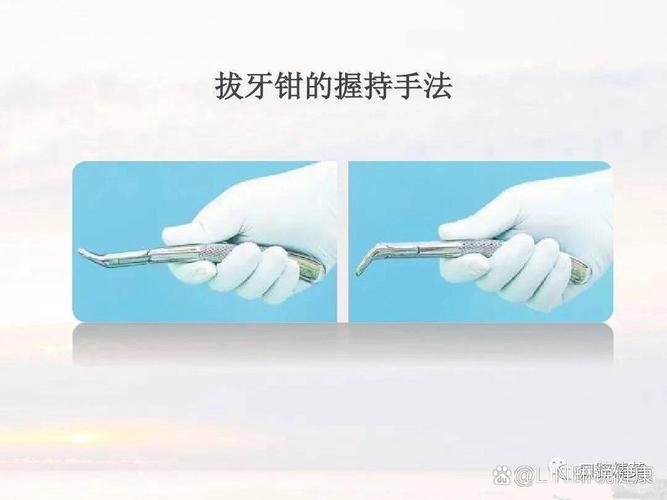 拔牙铤子的正确使用方法是什么？新手操作时有哪些关键步骤和需要注意的禁忌？-图2