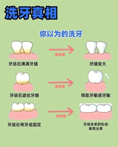 在口腔修复临床操作中,常用的排龈方法有哪些?不同方法的具体操作步骤、适应症及注意事项分别是什么?-图3 在口腔修复临床操作中,常用的排龈方法有哪些?不同方法的具体操作步骤、适应症及注意事项分别是什么?-图3