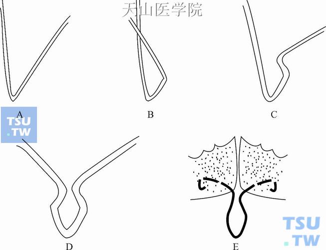 舌簧弯制方法图解中,具体弯制步骤有哪些?如何通过图示掌握关键技巧与常见问题解决方法?-图1 舌簧弯制方法图解中,具体弯制步骤有哪些?如何通过图示掌握关键技巧与常见问题解决方法?-图1