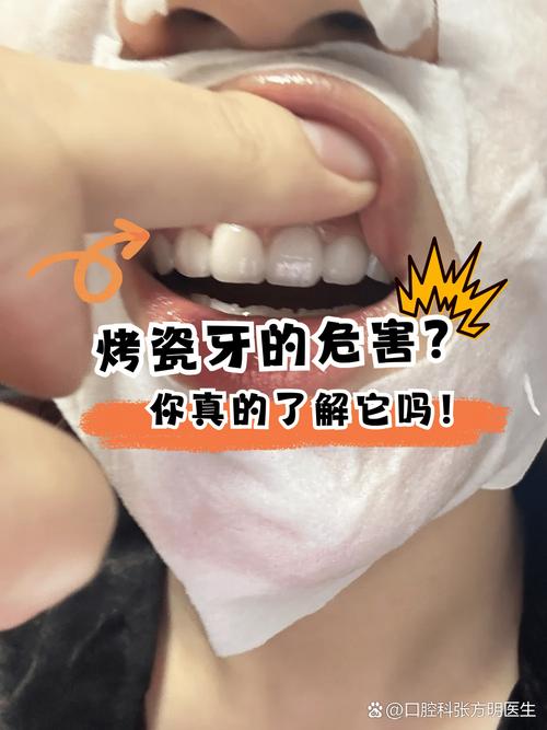 已经做过烤瓷牙的人,是否还能进行种植牙修复?有哪些注意事项和潜在影响需要考虑?-图1 已经做过烤瓷牙的人,是否还能进行种植牙修复?有哪些注意事项和潜在影响需要考虑?-图1