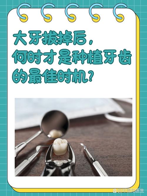 拔牙后马上种牙真的靠谱吗?即刻种植的可行性、风险与注意事项,你了解多少?-图2 拔牙后马上种牙真的靠谱吗?即刻种植的可行性、风险与注意事项,你了解多少?-图2