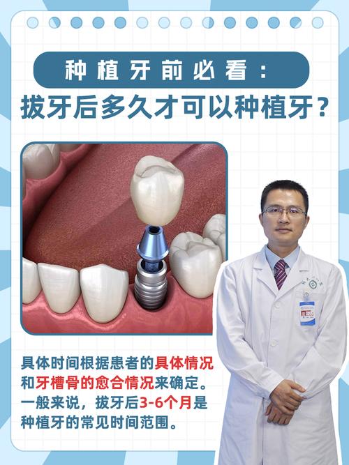 拔牙后马上种牙真的靠谱吗?即刻种植的可行性、风险与注意事项,你了解多少?-图3 拔牙后马上种牙真的靠谱吗?即刻种植的可行性、风险与注意事项,你了解多少?-图3