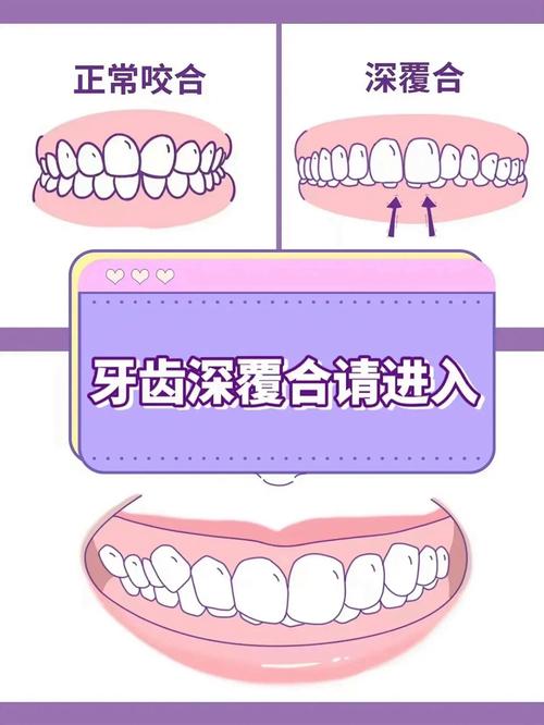 牙不齐若选择不矫正，会对口腔健康和面部美观造成哪些潜在影响？-图2