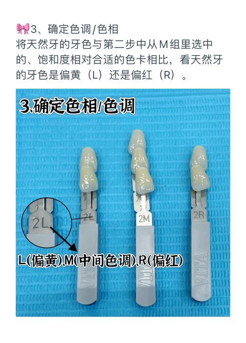 备牙前比色如何确保修复体颜色自然逼真?比色板选择与自然光环境下的关键操作要点是什么?-图3 备牙前比色如何确保修复体颜色自然逼真?比色板选择与自然光环境下的关键操作要点是什么?-图3