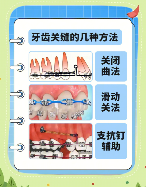 零基础学正畸方法-图1