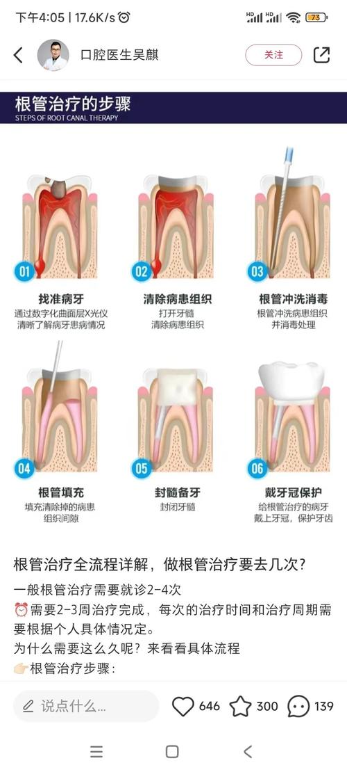 分根术的手术方法具体如何操作?不同适应症下的关键步骤、技术细节及术后注意事项有哪些?-图3 分根术的手术方法具体如何操作?不同适应症下的关键步骤、技术细节及术后注意事项有哪些?-图3