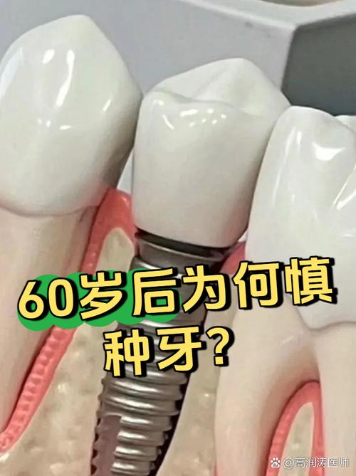 60岁种牙还值得吗？身体机能下降、手术风险、效果持久性与性价比该如何权衡？-图2