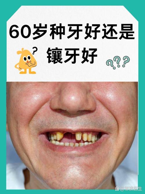 老年人不种牙真的可行吗?长期缺牙对身体和日常生活会带来哪些潜在影响?-图1 老年人不种牙真的可行吗?长期缺牙对身体和日常生活会带来哪些潜在影响?-图1