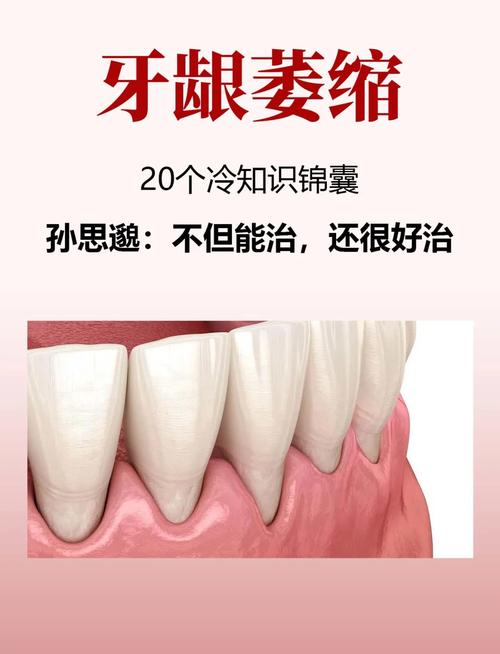 牙齿出现疼痛、敏感、出血等不同牙症,究竟该如何科学选择针对性治疗方法?-图2 牙齿出现疼痛、敏感、出血等不同牙症,究竟该如何科学选择针对性治疗方法?-图2