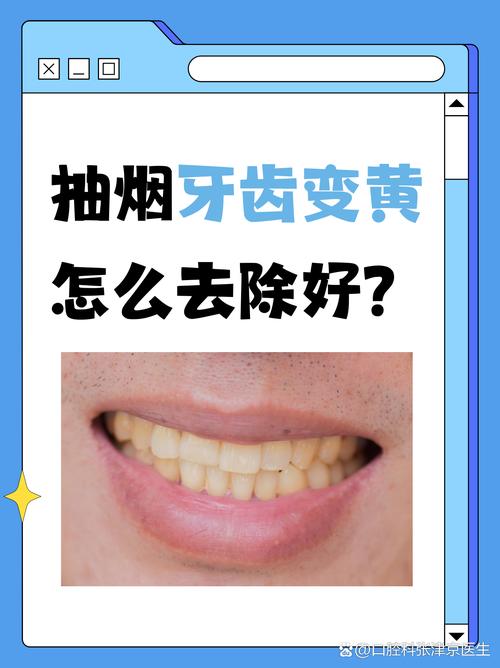 种牙后四天就想抽烟?小心感染、骨结合失败,这些恢复风险你真的了解吗?-图3 种牙后四天就想抽烟?小心感染、骨结合失败,这些恢复风险你真的了解吗?-图3
