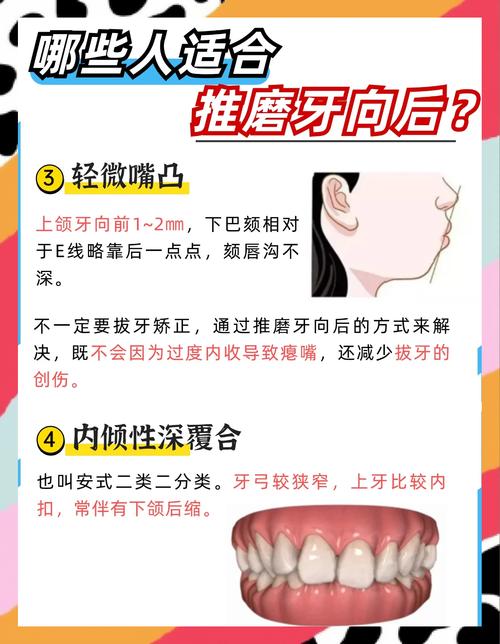 牙齿矫正结束后,后槽牙会发生移动吗?原因和潜在影响有哪些?-图1 牙齿矫正结束后,后槽牙会发生移动吗?原因和潜在影响有哪些?-图1