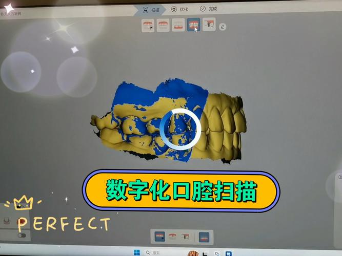 无牙合患者的印模方法有哪些？不同技术如何影响义齿适配性与长期稳定性？-图2