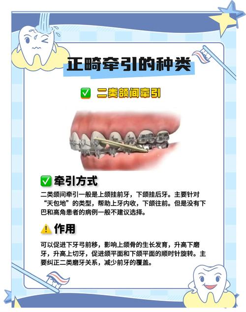 正畸矫治技术的发展呈现出哪些核心特点，这些特点如何推动临床诊疗模式与患者体验的双重革新？-图2