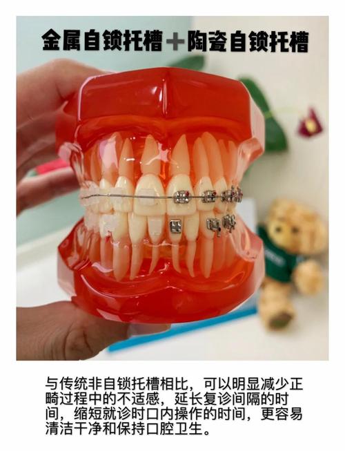 第二磨牙出现缺损或移位时，正畸矫正和牙冠修复哪个方案更优？需结合牙齿情况、治疗周期及长期效果如何权衡？-图2