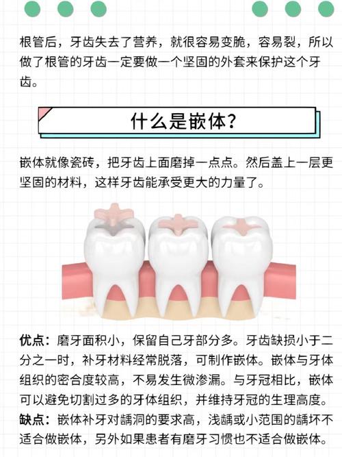 牙齿茜体支配方法具体指什么?其实施步骤和适用场景有哪些?-图1 牙齿茜体支配方法具体指什么?其实施步骤和适用场景有哪些?-图1