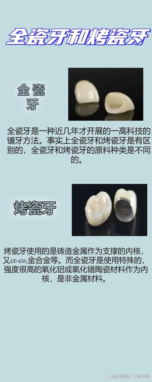 烤瓷牙与种牙在修复原理、适用人群及使用寿命上究竟有何不同？如何根据牙齿缺损情况选择更合适的修复方式？-图3