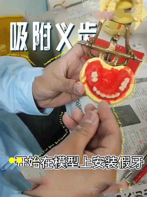义齿隐形制作方法中,数字化扫描、3D打印及材料选择如何协同保障精准适配与隐形效果?-图1 义齿隐形制作方法中,数字化扫描、3D打印及材料选择如何协同保障精准适配与隐形效果?-图1