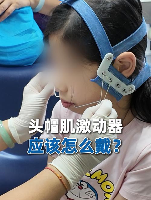 制作肌激动器的具体步骤有哪些？需要准备哪些材料和工具？过程中有哪些关键注意事项需重点关注？-图1