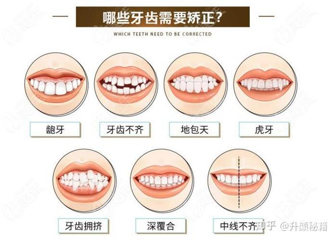南京正畸医院排名前十的依据是什么？如何判断这份榜单是否客观权威？-图2
