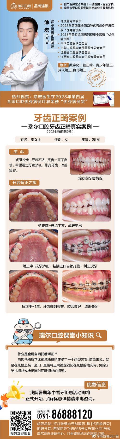 口腔正畸进修结束后，如何将前沿技术融入日常临床实践并实现个人专业能力的持续跃升？-图3