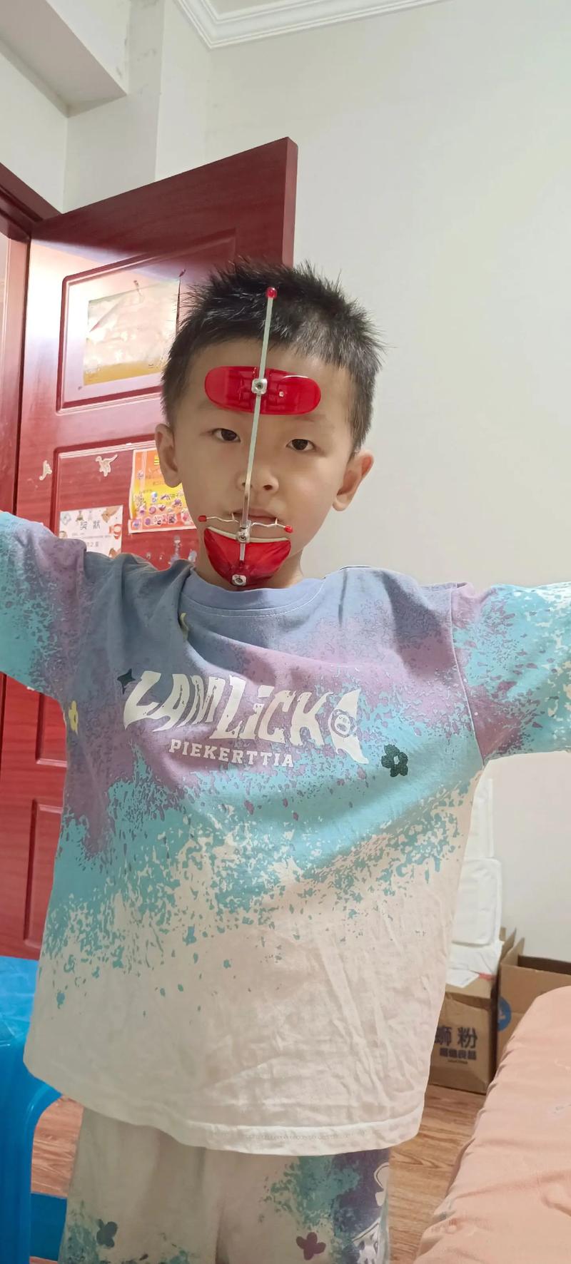 正畸中上颌尖牙向下向后牵引的原理是什么?适用于哪些错颌畸形?临床操作中如何控制牵引方向与效果?-图1 正畸中上颌尖牙向下向后牵引的原理是什么?适用于哪些错颌畸形?临床操作中如何控制牵引方向与效果?-图1