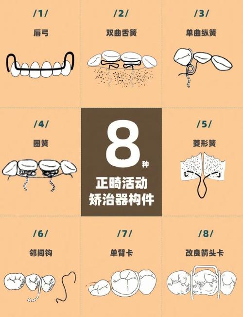 预防性矫治的方法-图2