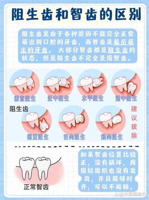 阻生智齿分牙有哪些常用方法?不同阻生类型如何选择最佳分牙方式?效果与术后恢复有何差异?-图2 阻生智齿分牙有哪些常用方法?不同阻生类型如何选择最佳分牙方式?效果与术后恢复有何差异?-图2