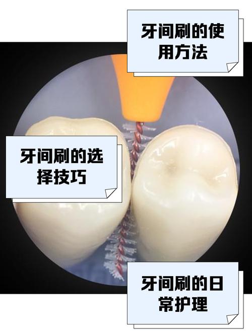间隙刷使用方法6的具体步骤是什么?正确操作时需注意哪些细节才能避免损伤牙龈?-图1 间隙刷使用方法6的具体步骤是什么?正确操作时需注意哪些细节才能避免损伤牙龈?-图1