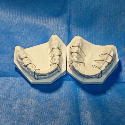 正畸箭头卡环弯制视频是否详细演示了托槽定位与角度控制?弯制过程中需注意哪些关键细节才能确保固位稳定?-图3 正畸箭头卡环弯制视频是否详细演示了托槽定位与角度控制?弯制过程中需注意哪些关键细节才能确保固位稳定?-图3