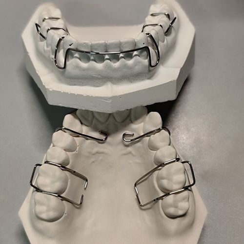 正畸箭头卡环弯制视频是否详细演示了托槽定位与角度控制？弯制过程中需注意哪些关键细节才能确保固位稳定？-图2