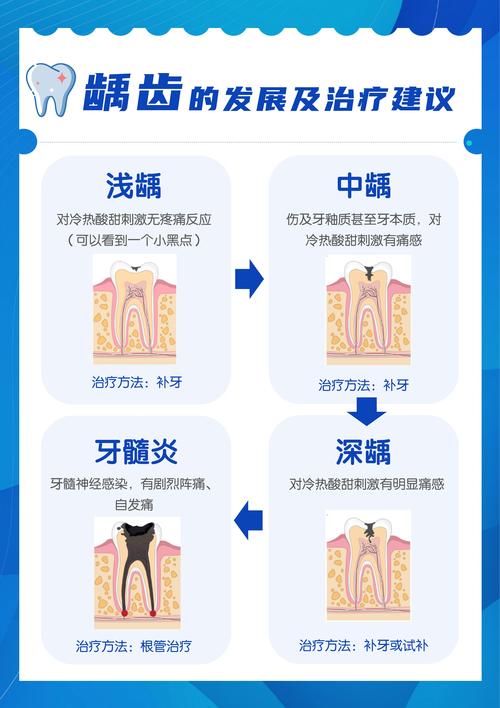 龋病的治疗方法有哪些？不同严重程度下该如何选择？最新进展又有哪些？-图1