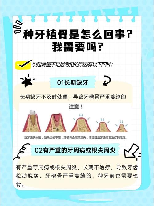 植骨后到底要等多久才能安全种牙？这些关键因素决定你的种植时间！-图3