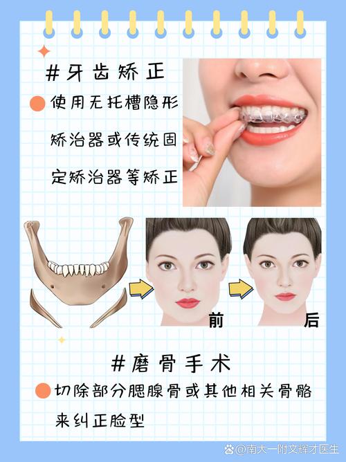 下颌78正畸前移的具体方法有哪些？不同错颌畸形类型下如何选择最优术式？-图3