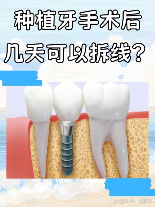 种牙二期手术拆线后需要注意哪些事项？拆线时间有统一标准吗？拆线过程会疼吗？-图1