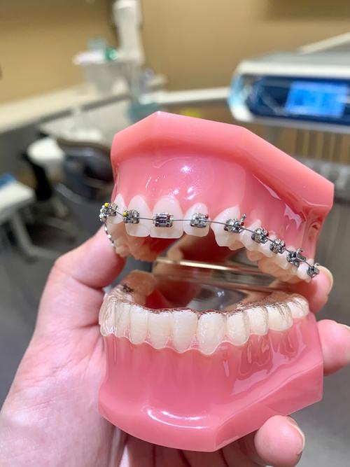 沈阳奥新全民口腔正畸效果如何?不同年龄段矫正有哪些注意事项?价格是否透明?-图2 沈阳奥新全民口腔正畸效果如何?不同年龄段矫正有哪些注意事项?价格是否透明?-图2