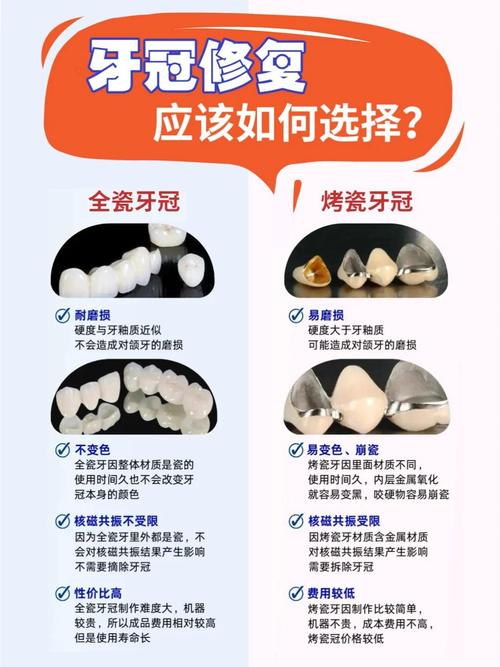 正畸陶瓷牙套 优缺点-图2