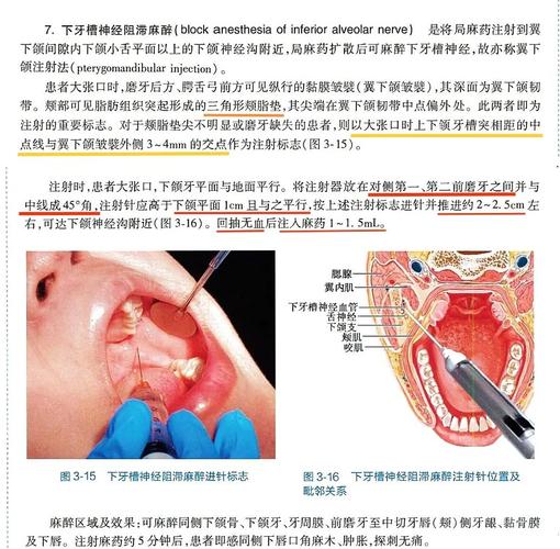 针对不同牙齿（前牙、后牙、乳牙、恒牙），麻醉方法应如何精准选择？注射部位与药物应用有何差异？-图1