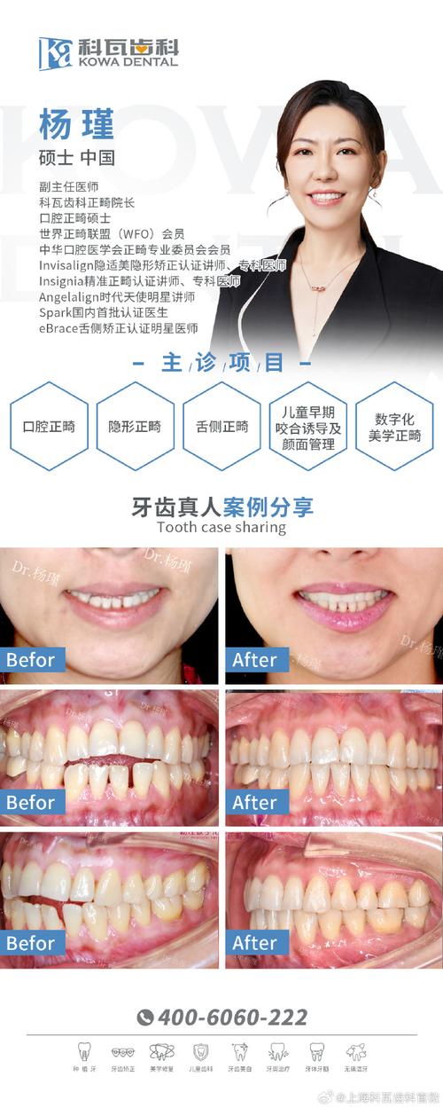 上海牙齿正畸口腔机构怎么选？专业资质、效果口碑和性价比哪个更重要？-图3