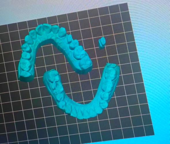 口腔数字修复方法与传统修复方法有何不同?-图1 口腔数字修复方法与传统修复方法有何不同?-图1