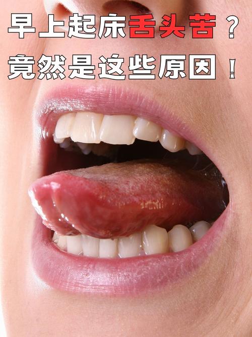 正畸前几天舌头特别苦-图1