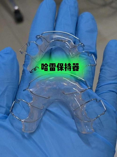 正畸后牙齿终生戴保持器，真的需要戴一辈子吗？-图2