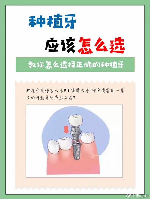 种牙种植体好坏,关键看哪些因素?-图3 种牙种植体好坏,关键看哪些因素?-图3