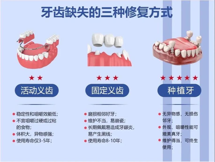 植牙修复有哪些常用的修复方式？-图1