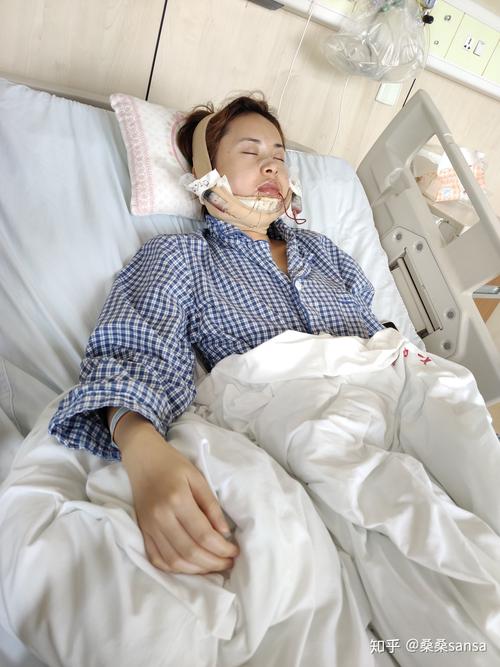 颌骨正畸手术住院一般需要住院多久？-图2