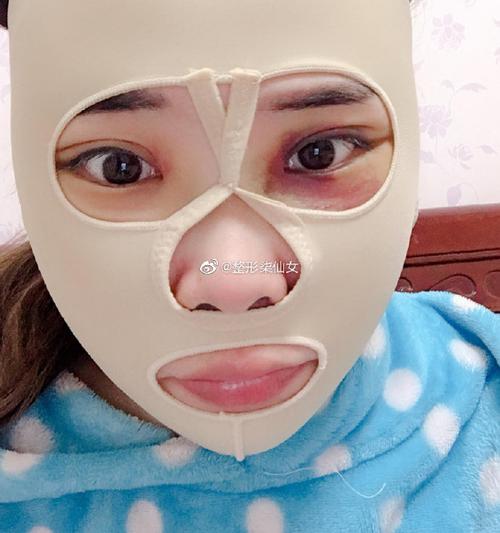 颌骨正畸手术住院一般需要住院多久？-图3