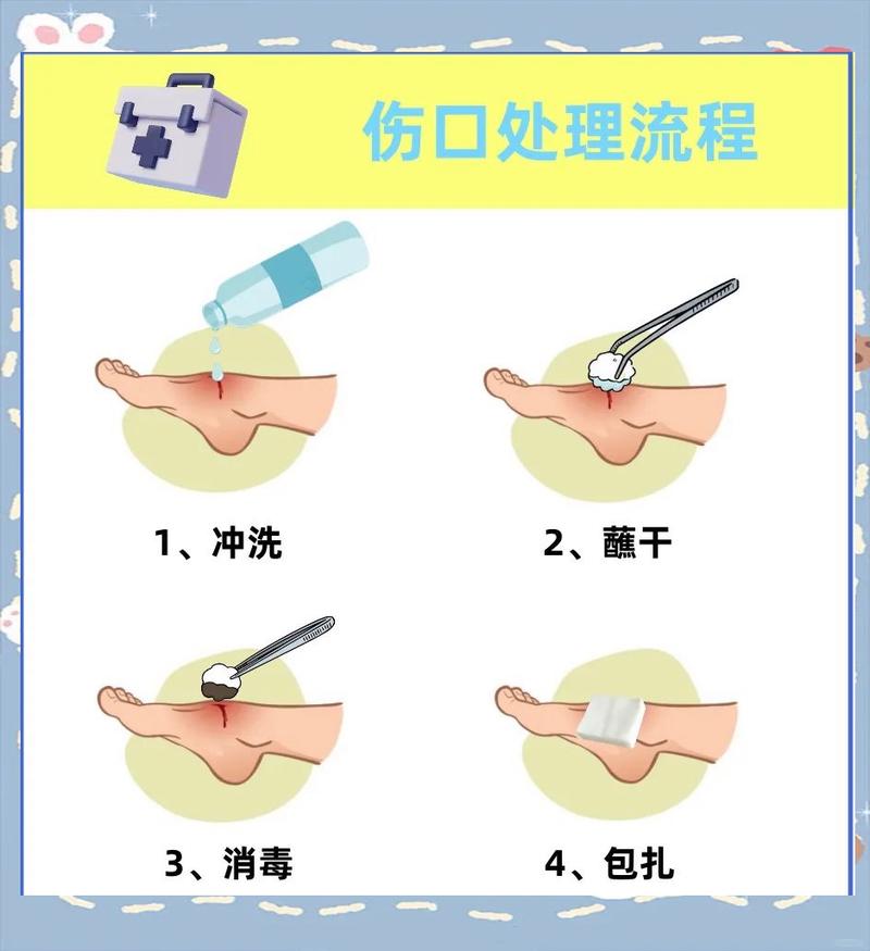 如何正确消毒牙科挫针？-图1