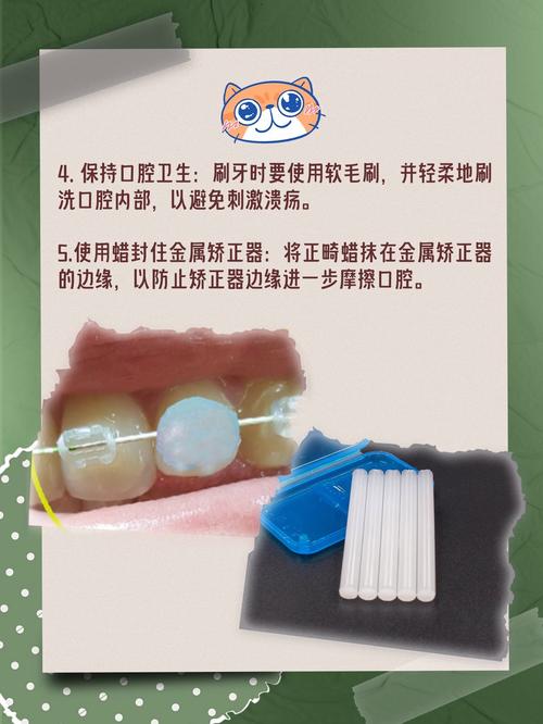 正畸口腔溃疡频发，如何有效预防？-图2