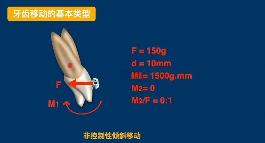 正畸阻抗中心这一名词具体指什么？-图2