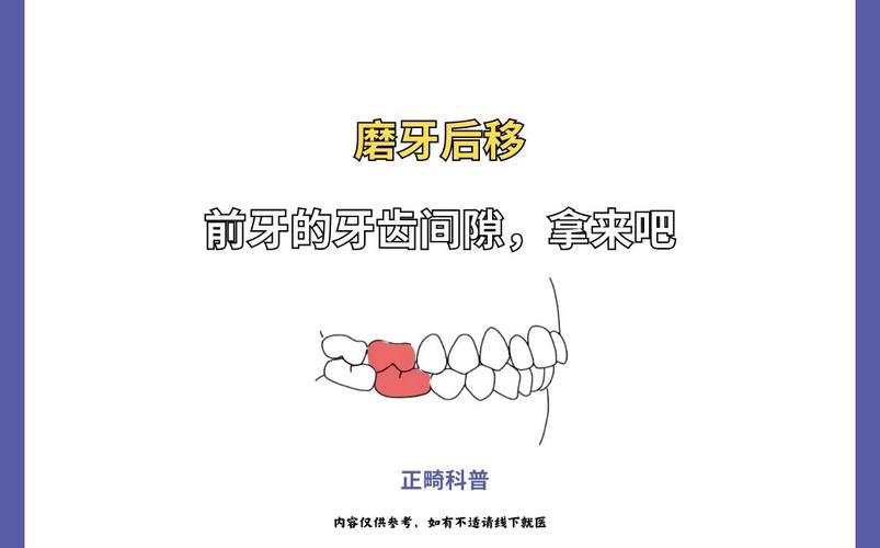 正畸后磨牙移动速度的影响因素有哪些?-图1 正畸后磨牙移动速度的影响因素有哪些?-图1