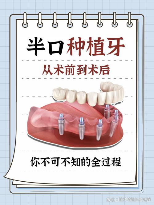 种半口牙需要住院吗?术后恢复要注意什么?-图2 种半口牙需要住院吗?术后恢复要注意什么?-图2